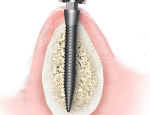 MDI Cross Section